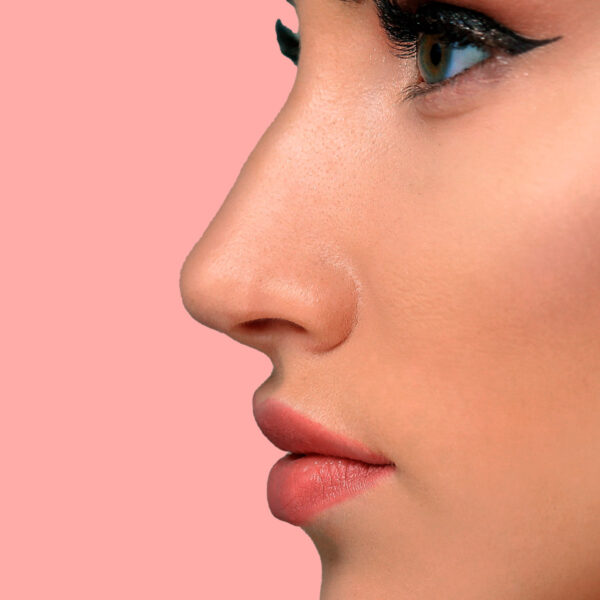 Rhinoplastika – operácia nosa na úpravu tvaru a symetrie pre harmonický a prirodzený vzhľad tváre.