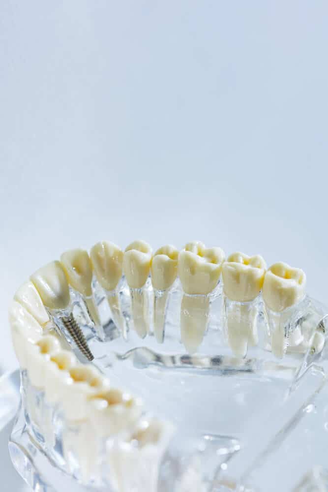 Sterilné operačné prostredie v Aurel Clinic pripravené na úspešné Zubné implantaty.