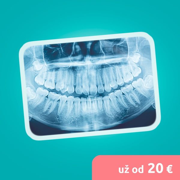 Panoramatická snímka zubov