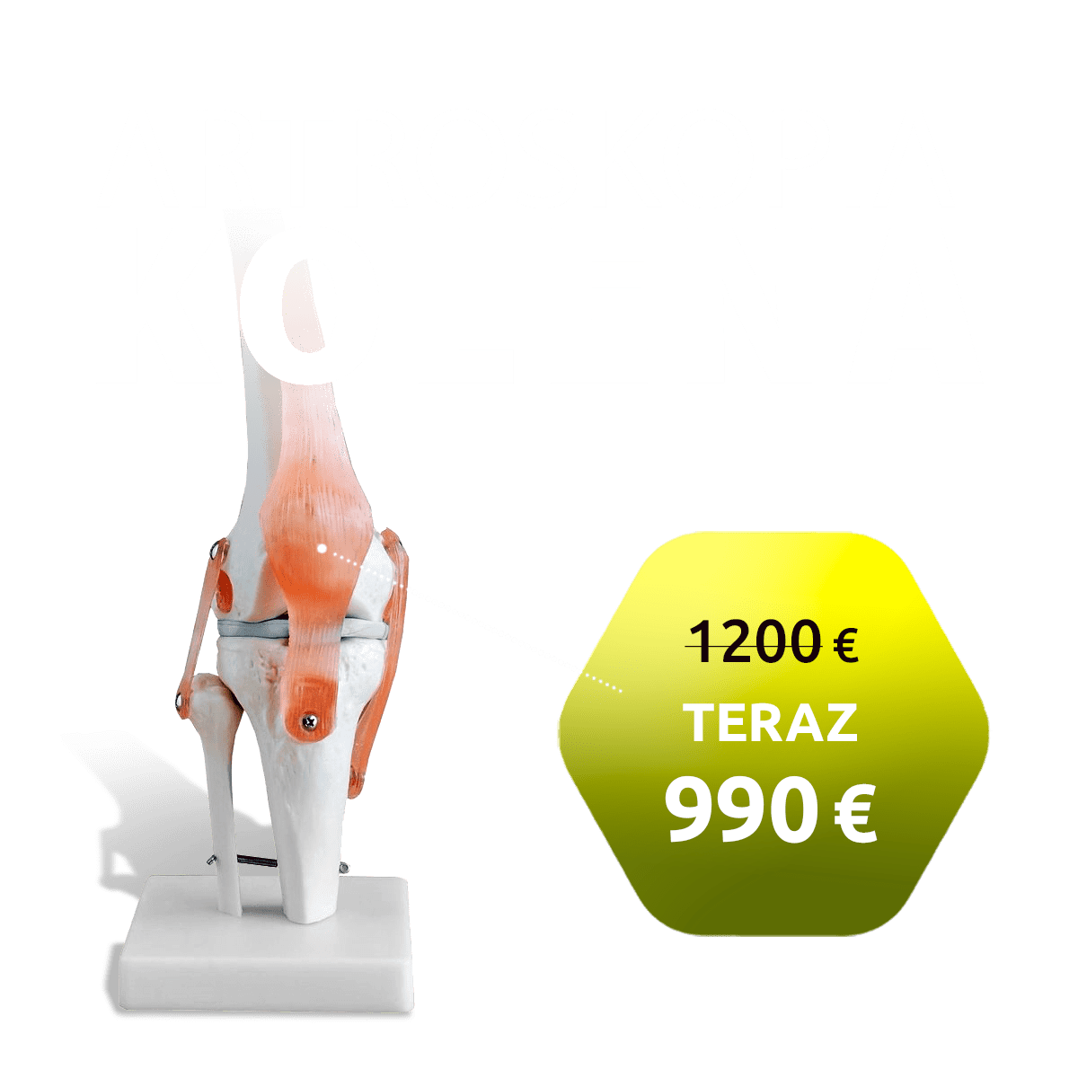 Slider-artro-kolena-01