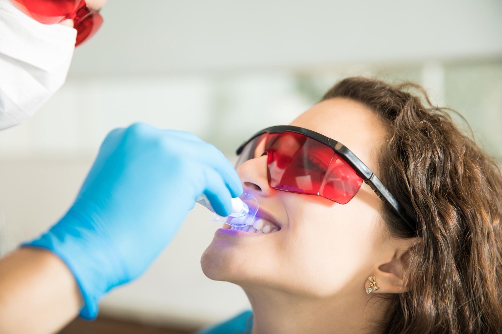 Prečo podstúpiť procedúru bielenia zubov